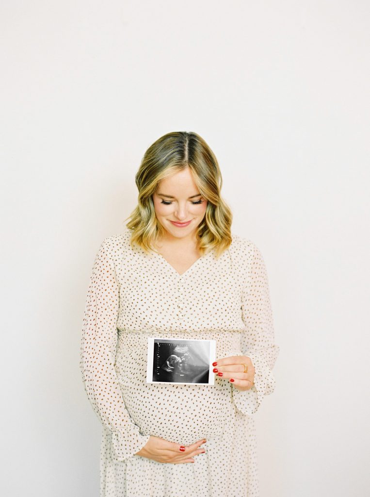 A pregnant woman holding a scan photo. 